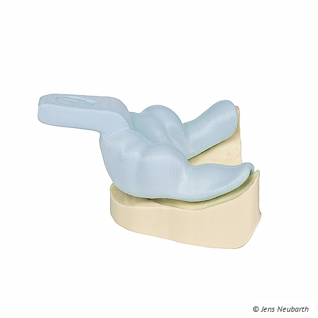 Zahntechnikmagazin - Funktionslöffel - Dental 3D Agency